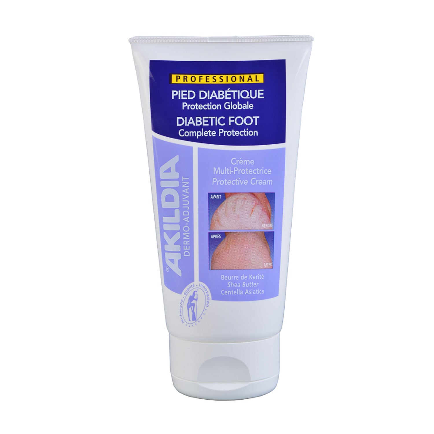 Akildia - Schutzcreme für den Diabetischen Fuß 150ml